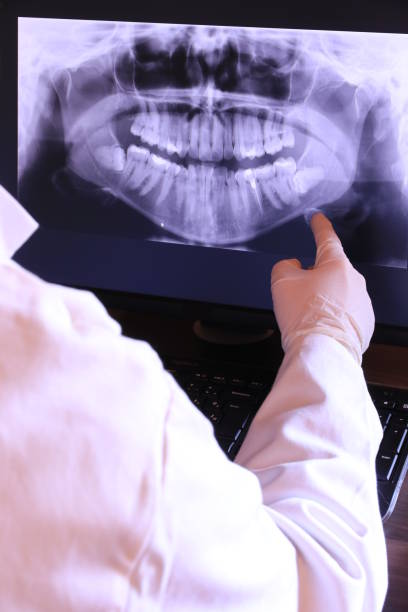 Best Emergency Root Canal Treatment in Adrian, MO